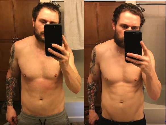 El 'antes y después' de Anthony | Absandicecream.com