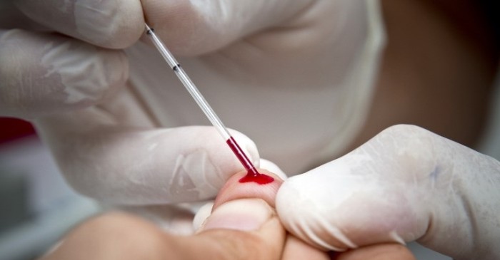 Según estudio niña que nació con VIH está en remisión luego de 9 años sin medicamentos