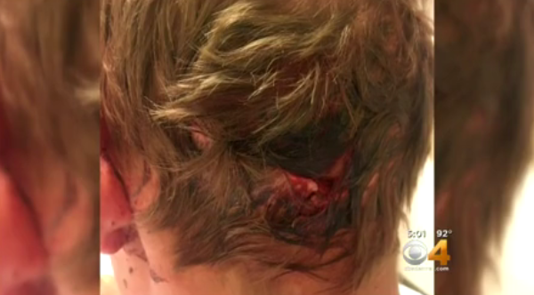 Las heridas | CBS Denver