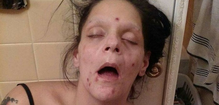 Mujer compartió en Facebook su impactante recuperación tras ser adicta a la heroína