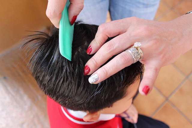 La novedosa técnica que llegó a Chile para acabar con piojos: aspiradora de cabeza