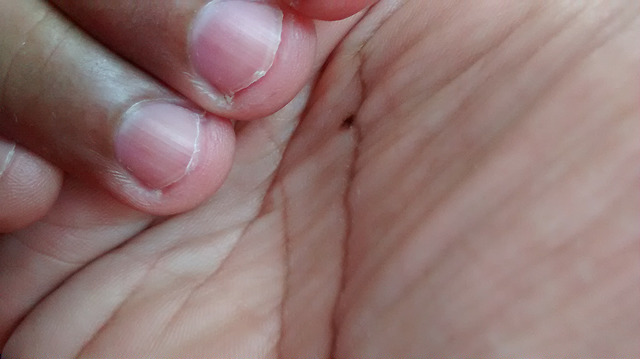 Manuelle Yosan (cc)/Flickr