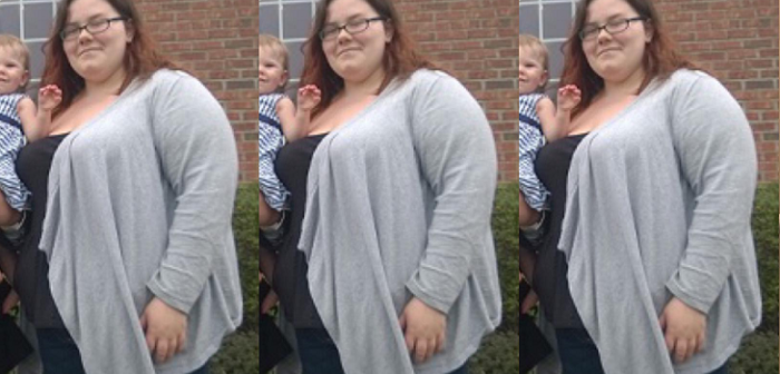 Mujer revela el lado B de la pérdida de peso: posee 20 kilos de más sólo de piel