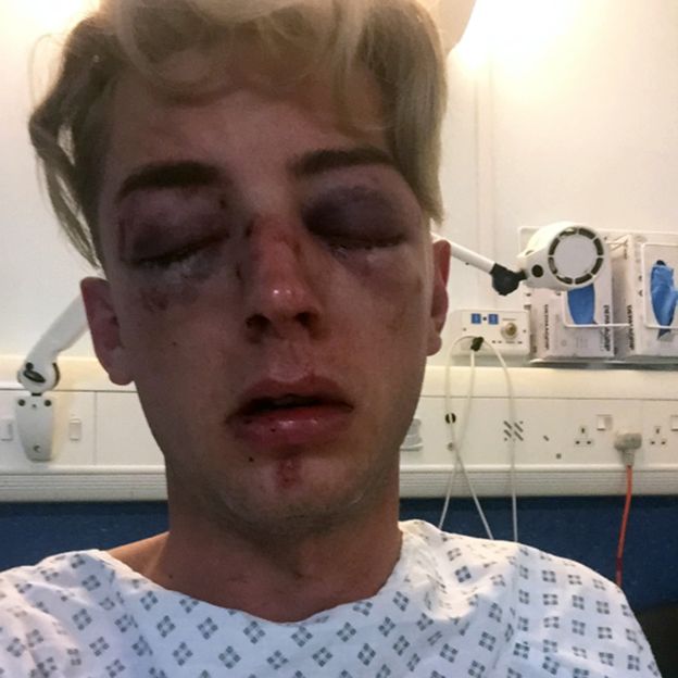 Dain | Foto personal