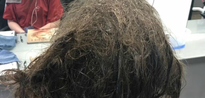 Joven mostró la triste realidad de la depresión tras no cepillar su pelo durante años