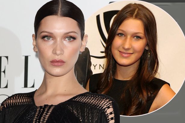 El antes y depsués de Bella Hadid | Mirror.co.uk