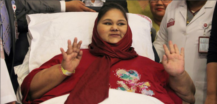Eman Ahmed: la mujer más obesa del mundo falleció por complicaciones cardíacas