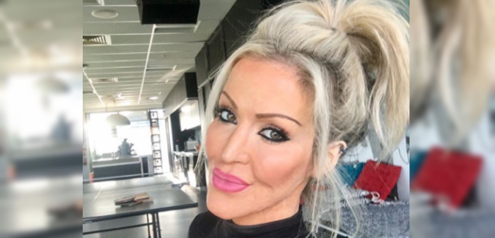 La increíble recuperación de una australiana quemada en su rostro y cuerpo por otra mujer