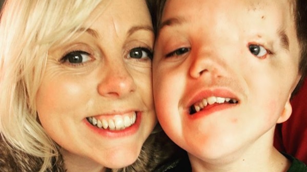 Madre critica a Instagram luego que eliminaran fotografía de su hijo por deformidad facial