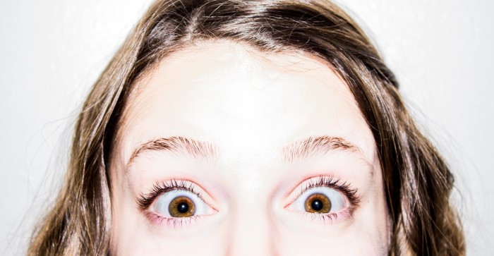 ¿Tienes caspa? 5 remedios caseros infalibles para combatirla