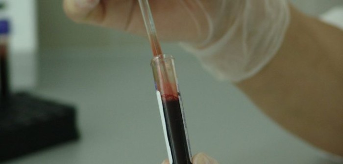 Arica y Santiago son las ciudades donde se aplicará test rápido de VIH