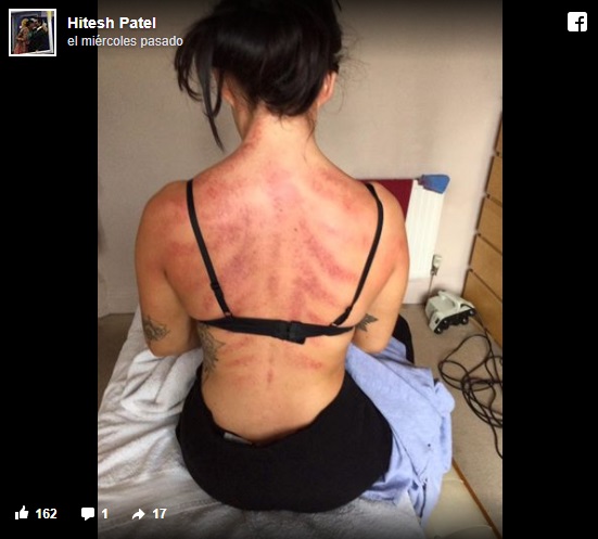 Hitesh Patel | Facebook