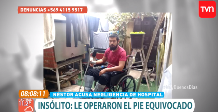 Insólita negligencia en Hospital Sótero del Río: a paciente le operaron el pie equivocado