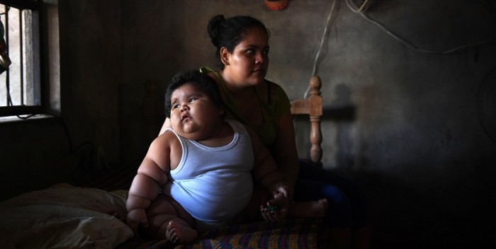 Bebé de 10 meses no para de engordar: pesa 28 kilos y médicos no encuentran la causa