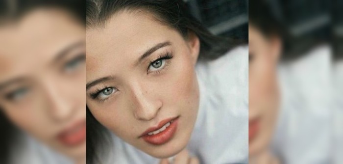 Difusor aromático dejó con graves quemaduras a joven: compartió fotos advirtiendo a otros