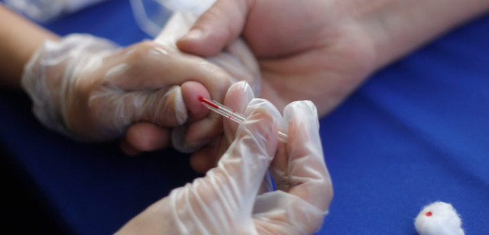 Hospital Clínico de la U. de Chile realizará gratuitamente 5 mil test para detectar VIH