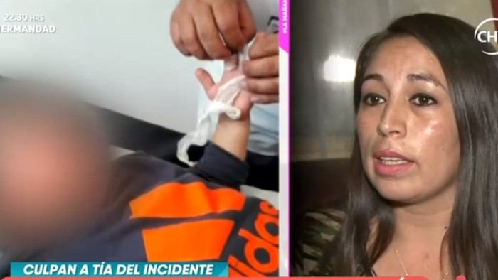 Niño de 4 años sufrió amputación de su dedo en jardín infantil de Lo Espejo