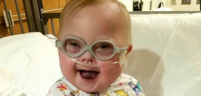 La emotiva foto de bebé con síndrome Down minutos antes de morir en brazos de su madre