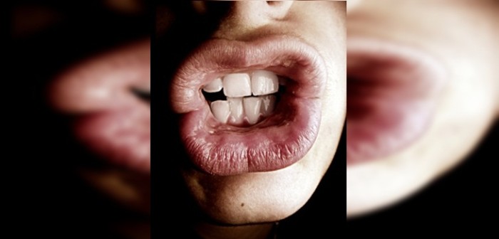 ¿Labios partidos? 5 simples consejos que te ayudarán a combatirlos