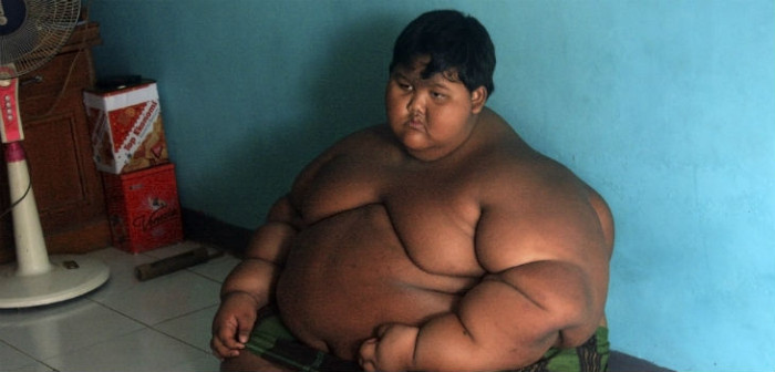 Era conocido como 'el niño más obeso del mundo': así luce tras 9 meses de dieta