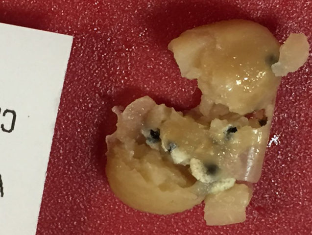 Cedida a Radio Bío Bío