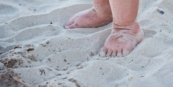 Indagan presunto maltrato contra niña de 3 años: mamá dice que se quemó en la playa