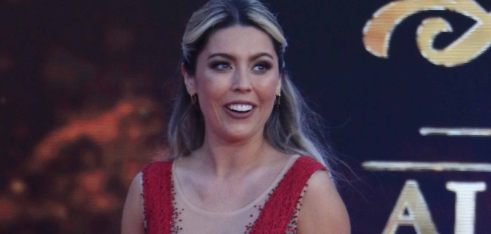 Daniela Aránguiz se puso ácido hialurónico en los labios y mostró los resultados