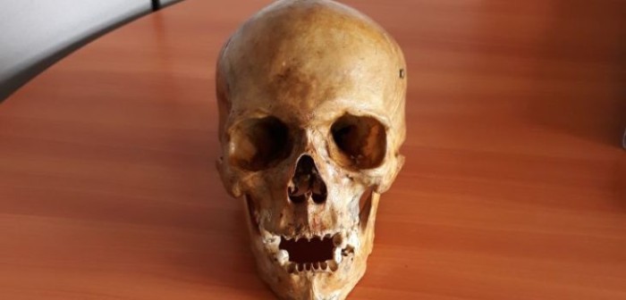 Estudiante de odontología fue detenida por tratar de ingresar un cráneo humano al país