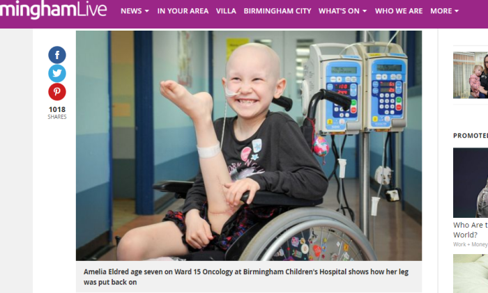 A niña le amputaron su pierna y se la volvieron a colocar al revés... pero no por error