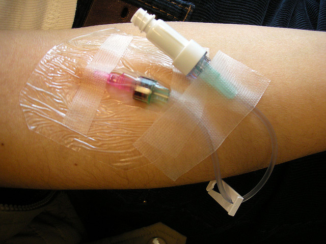 Agonizó por dos días: joven de 27 años murió tras ser embalsamada viva por error médico