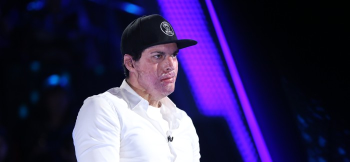 Neurocientífico da posible explicación a comentada actitud de Ignacio Lastra en Vértigo