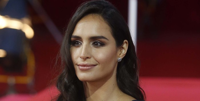 La historia detrás de la cicatriz de Fernanda Urrejola: sufrió grave accidente a los 16