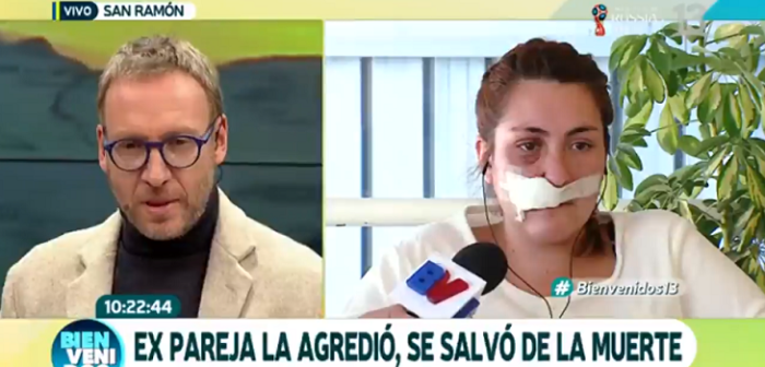 Mujer relató en Bienvenidos brutal agresión de expareja: le enterró un cuchillo en su cara