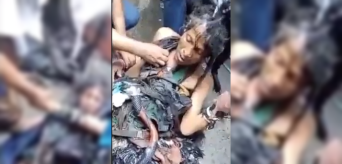 36 kilos de basura tenía pegada a su cuerpo indigente rescatado de la calle en El Salvador