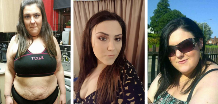 Bajó 40 kilos: joven que logró vencer la obesidad enfrenta los problemas por adelgazar