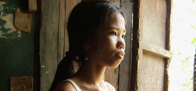 Fin del martirio: niña que ha vivido 14 años con gemelo parásito en su pecho será operada