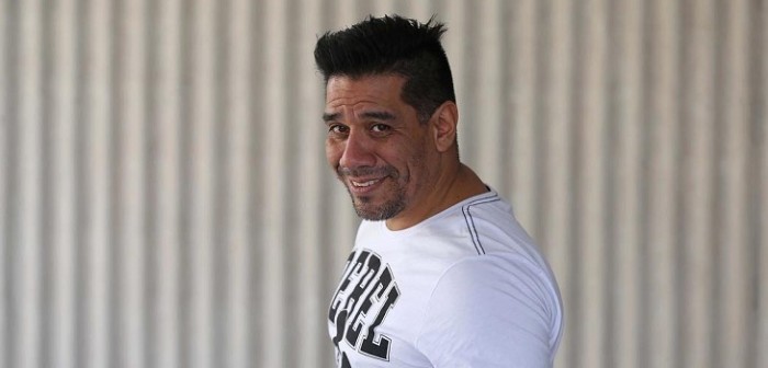 DJ Black se sometió a rejuvenecimiento facial para atenuar las arrugas de su rostro