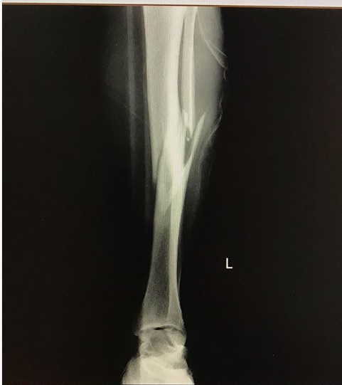 Maxi Ferres | Instagram