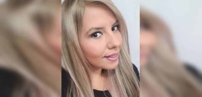 Gussy de 'Yingo' aumentó sus labios y mostró el resultado en Instagram