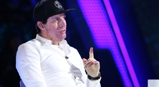 A 1 año del accidente: lo que habría influido en la rápida recuperación de Ignacio Lastra