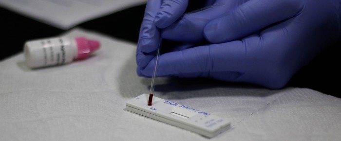 Insólito: municipio de Santiago cursa parte a ONG que realizaba test de VIH gratuitos