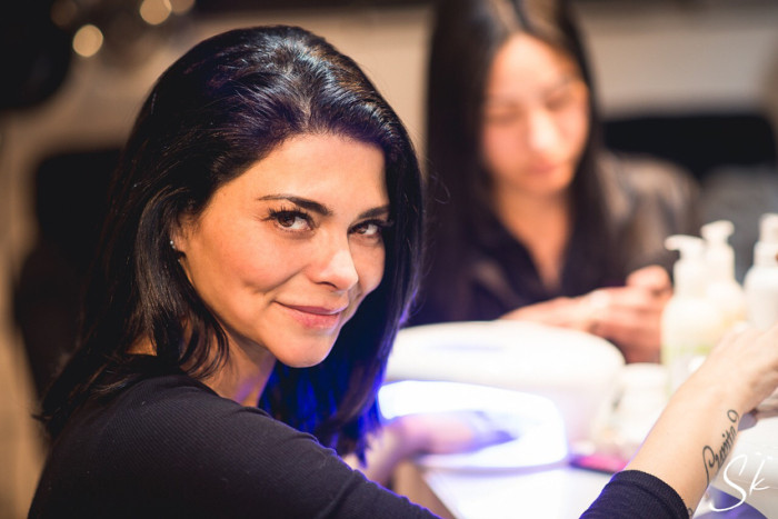 Antonella Ríos muestra su rostro antes y después de sacarse las bolas de bichat