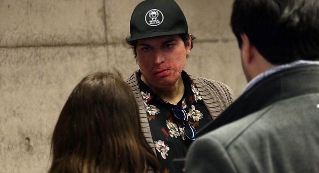 Ignacio Lastra sorprendió a seguidores con imagen que evidencia su avanzada recuperación