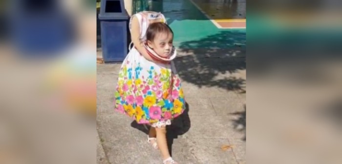El creativo disfraz de niña “sin cabeza” que se posiciona como el mejor del 2018