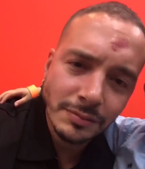 J Balvin | Instagram