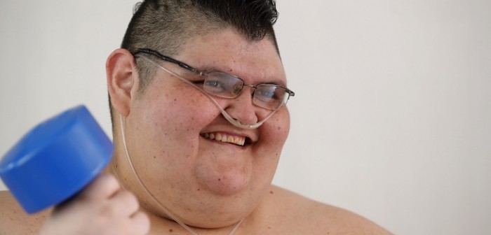 El hombre más obeso del mundo perdió la mitad de su peso: ahora ya puede ponerse de pie