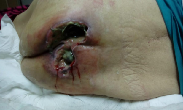 Cedida a Radio Bío Bío