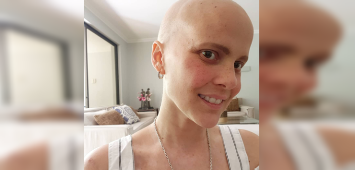 La alegría de Javiera Suárez tras terminar sus quimios: su pelo está volviendo a crecer