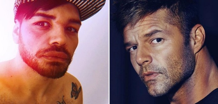 Argentino se operó el rostro 27 veces para quedar igualito a Ricky Martin: juzgue usted el resultado