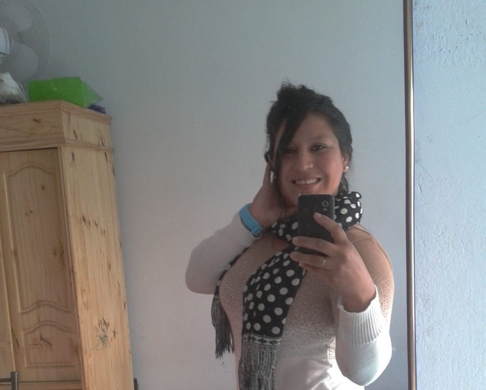 Mujer argentina quedó con el 45% del cuerpo quemado tras ataque de expareja: él está libre